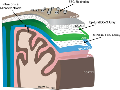 Neural Recording